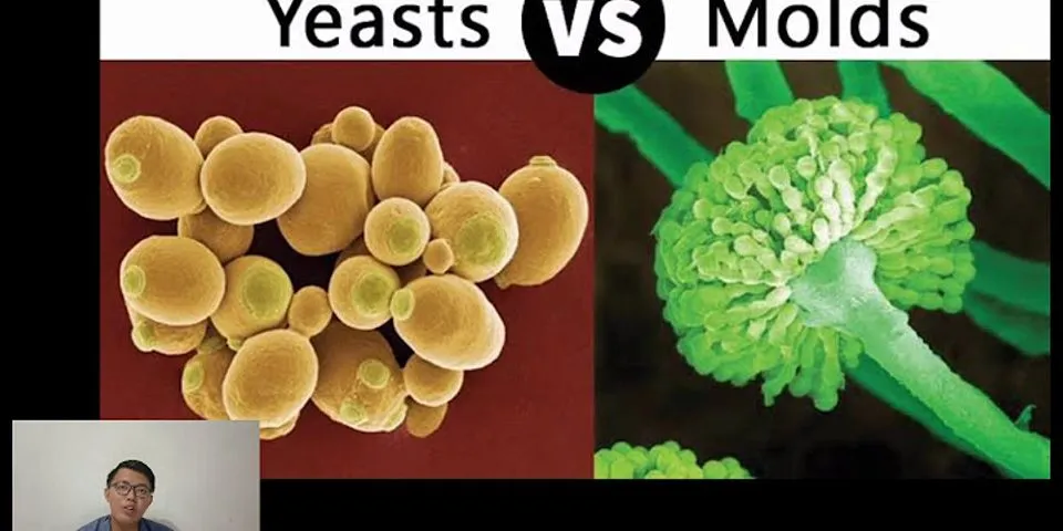 Perbedaan bakteri, kapang dan khamir